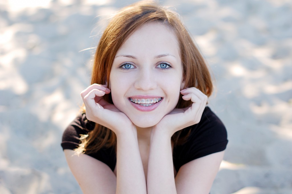 Braces for Teens