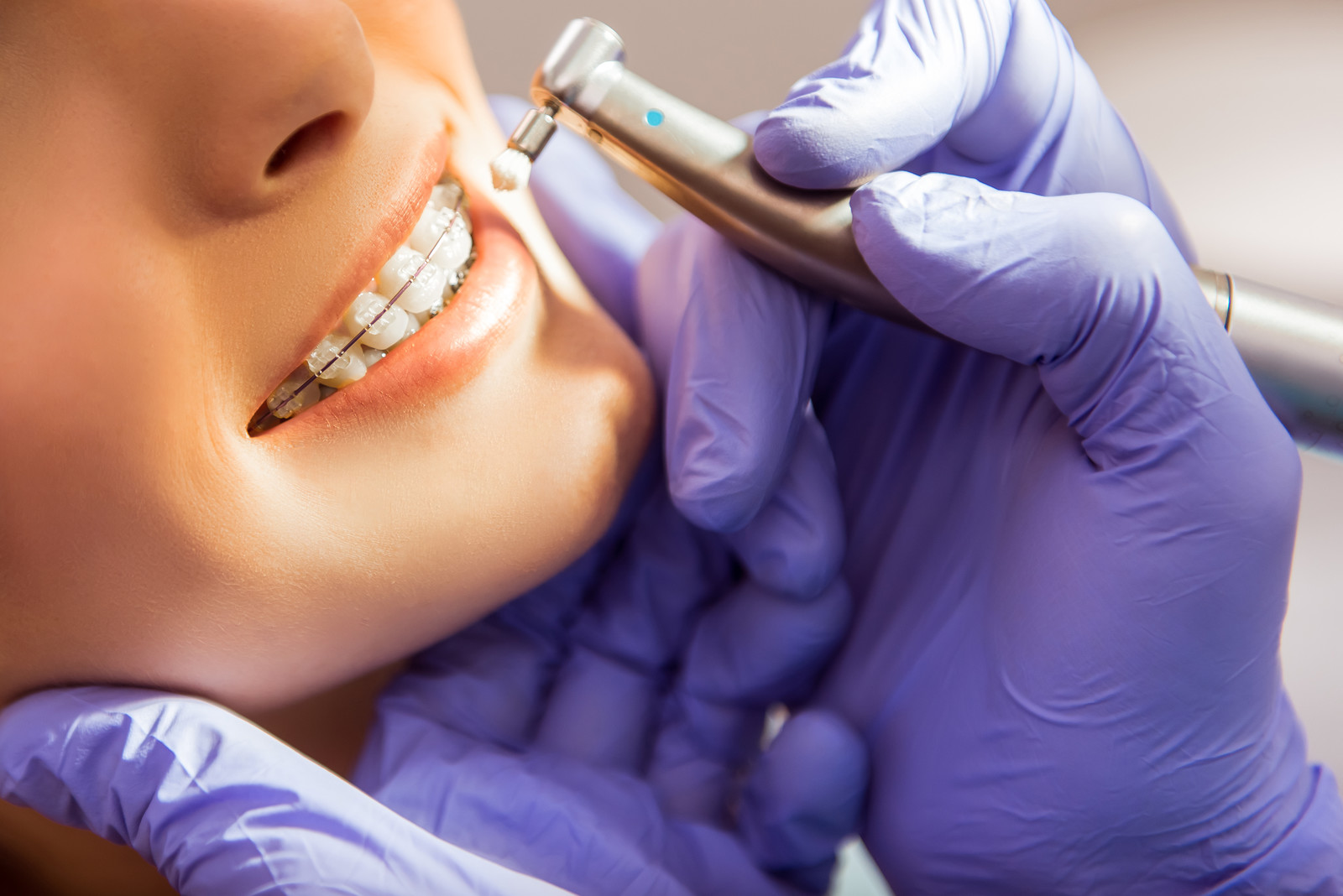 orthodontic procedures in Phoenix
