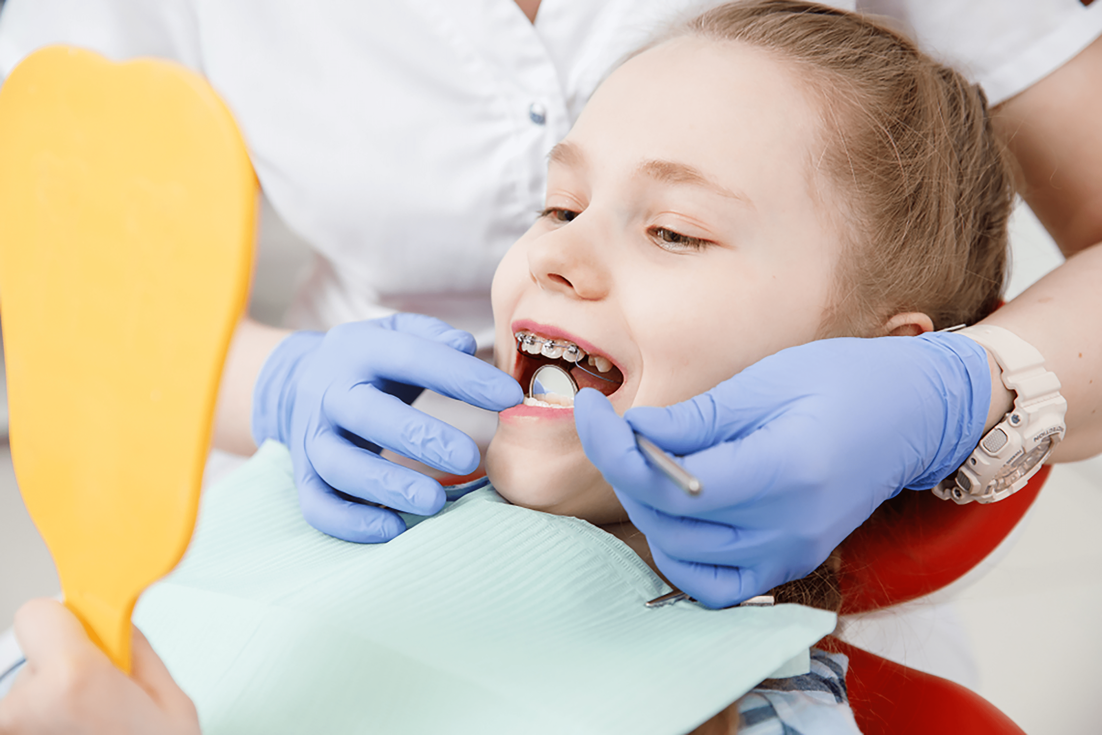 Braces for Teeth