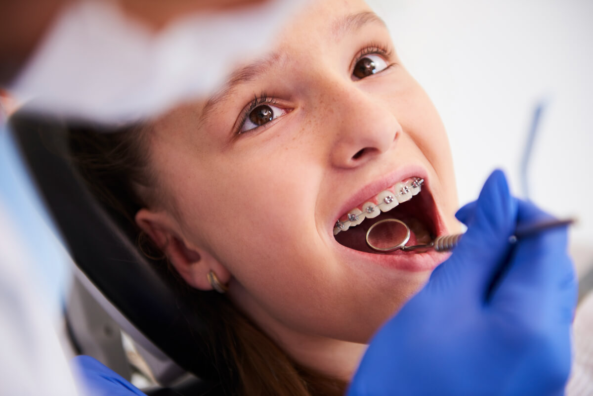 Top Tips for Looking after Your Braces