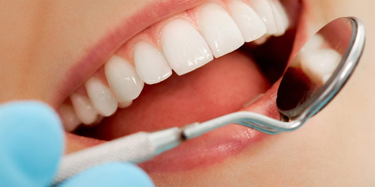 5 Reasons Why You May Wish To Get Your Teeth Whitened