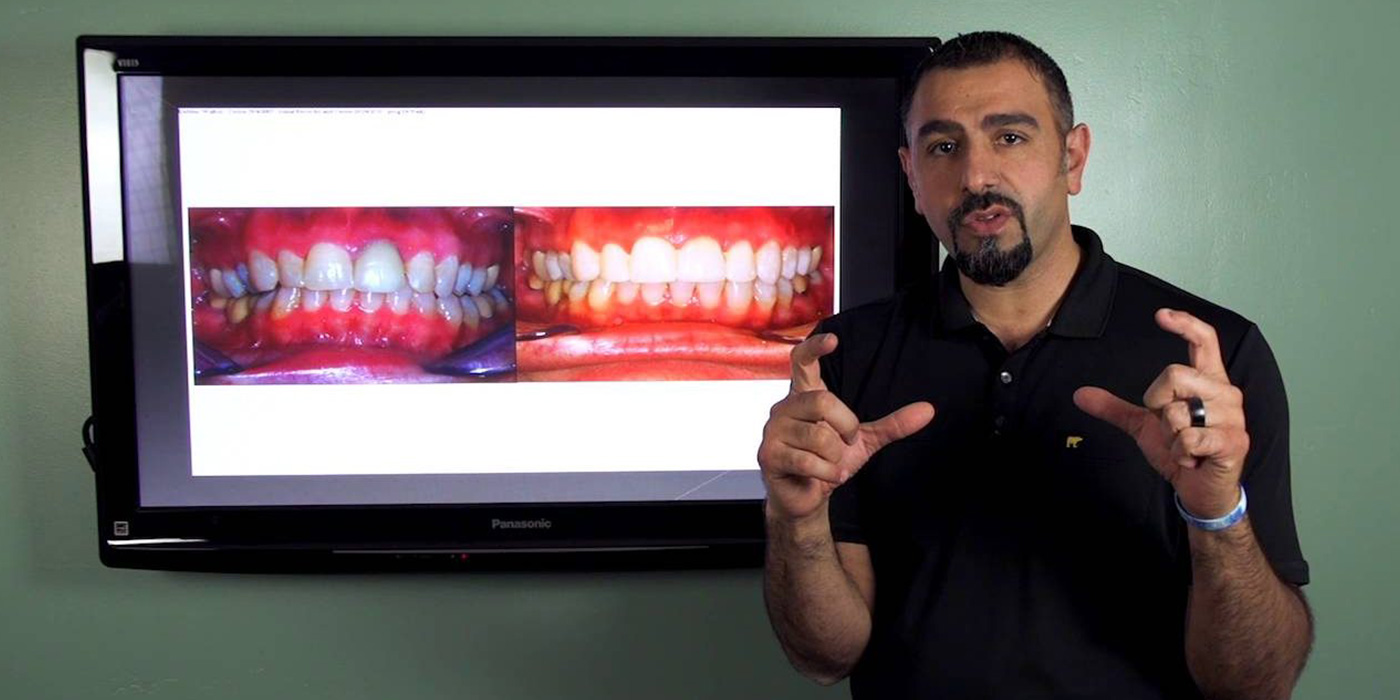 Cosmetic Dentistry VS Orthodontics Part 2