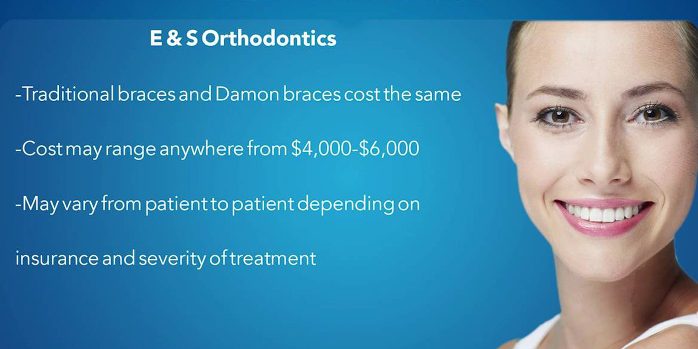 whats the cost of damon braces