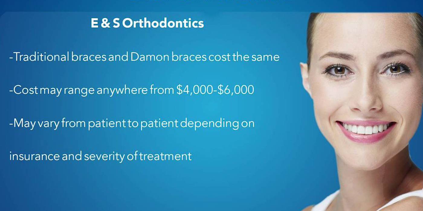 What’s The Cost Of Damon Braces?