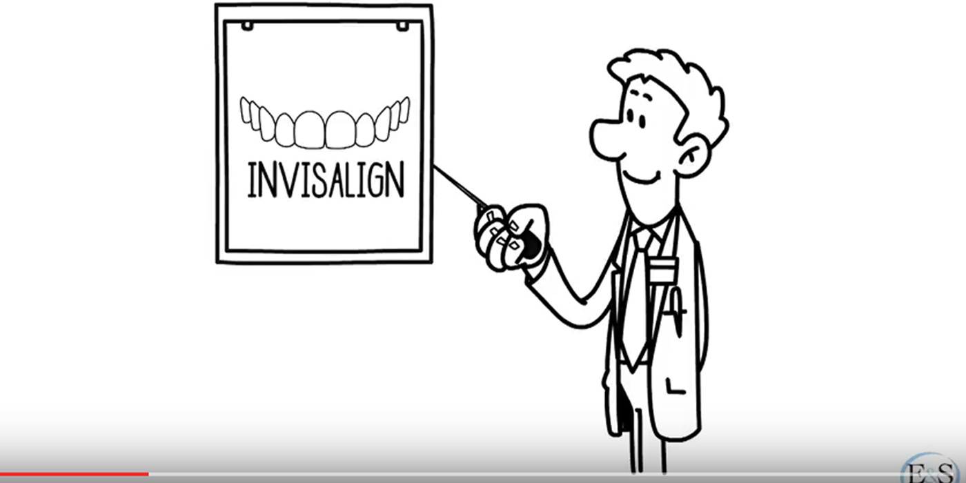 How Long Does Invisalign Treatment Take