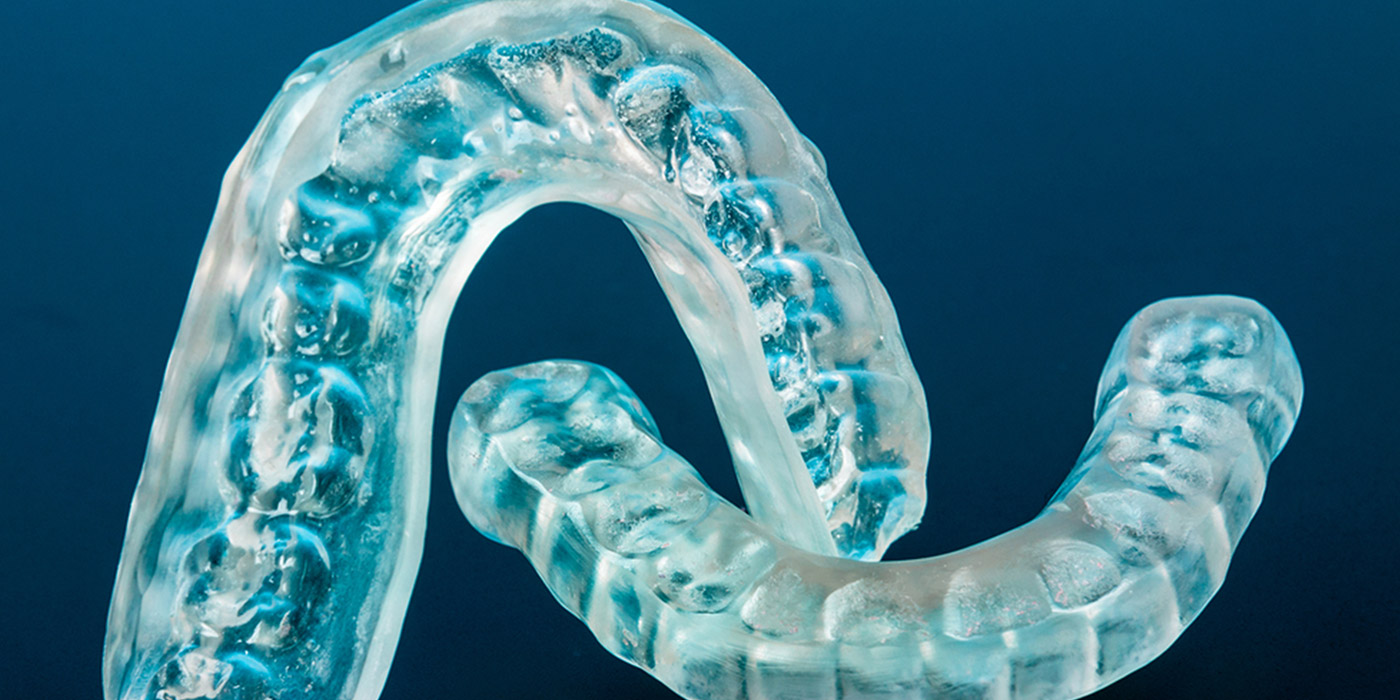 invisalign is worth or not in phoenix
