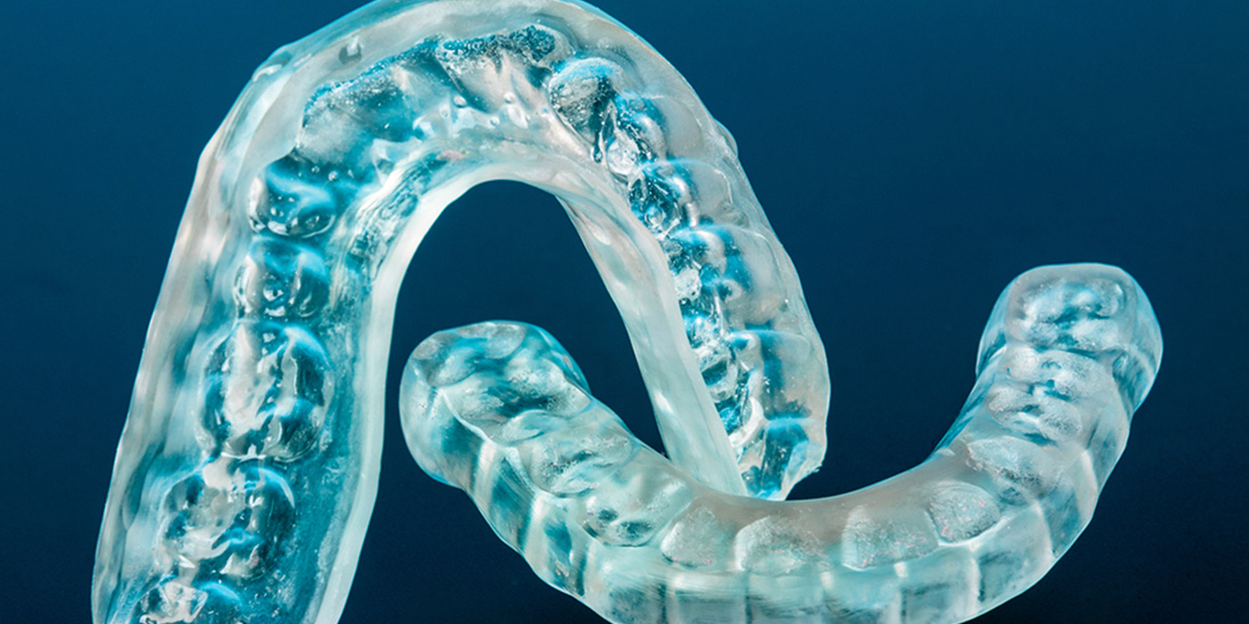 Is Invisalign Worth It or Not?