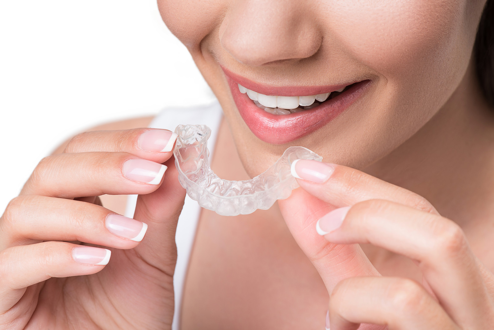 how does the invisalign process work