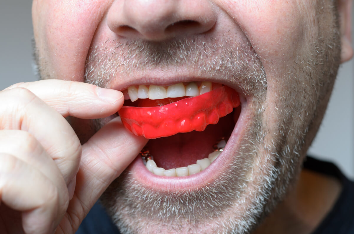how do mouthguards affect your orthodontic health