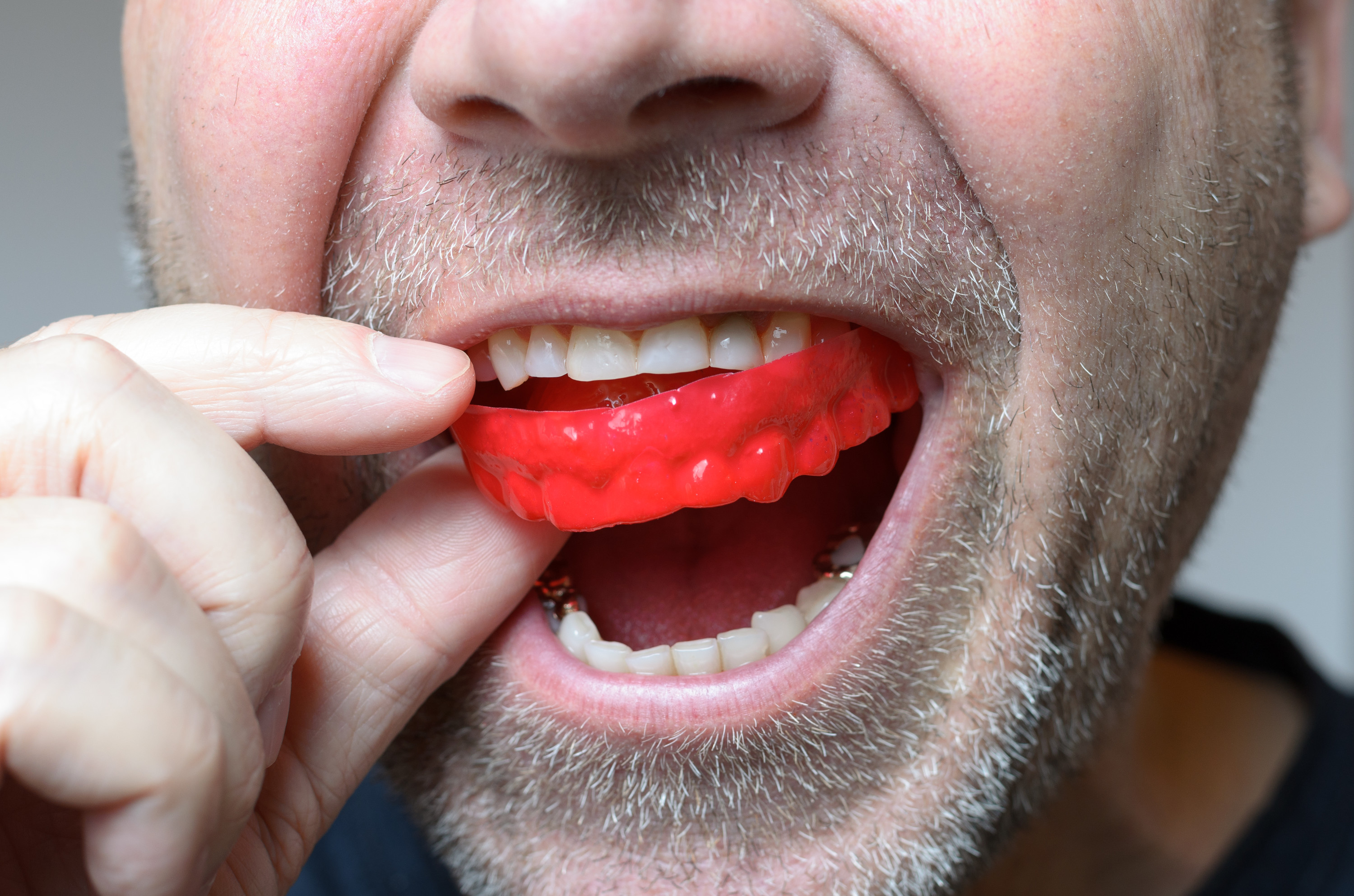 mouthguards affect your orthodontic health