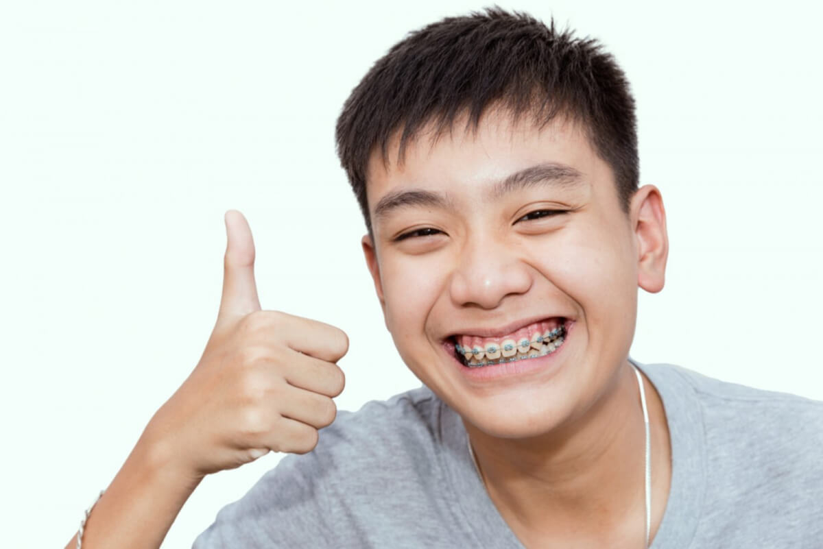 types of braces for adults, teens, and children
