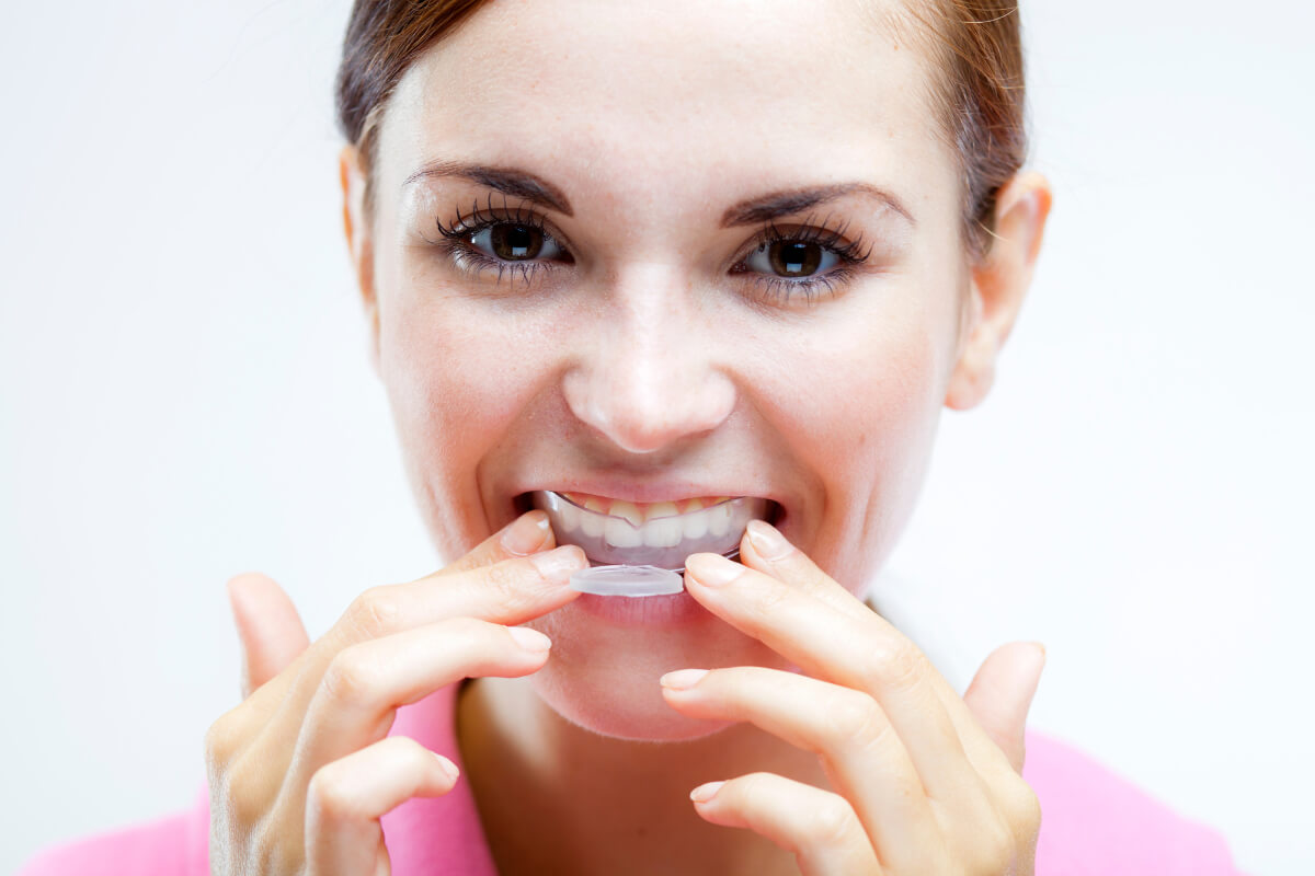 Your Guide to Mouthguards