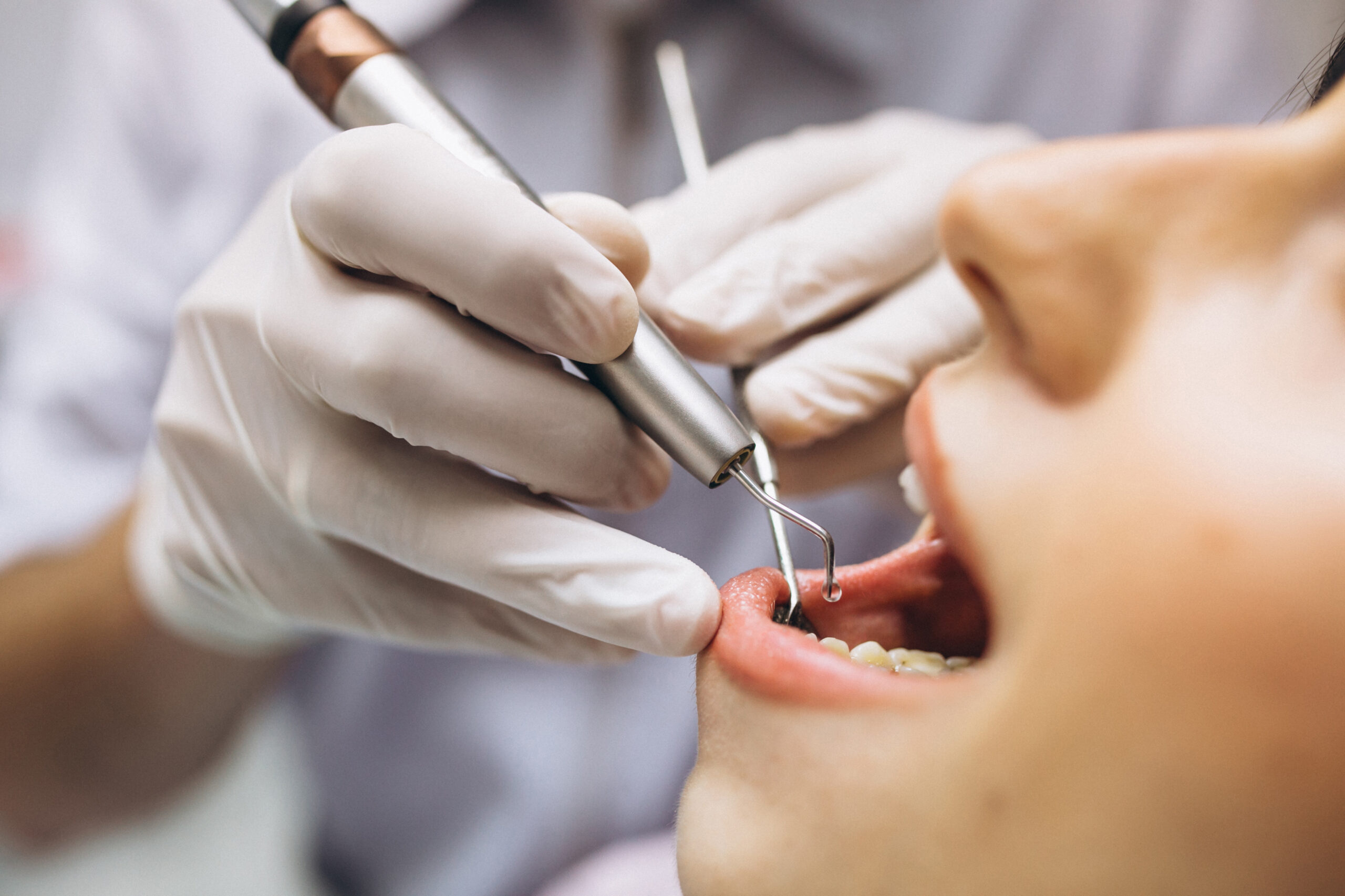 Can I Drink Coffee After Tooth Shaping?
